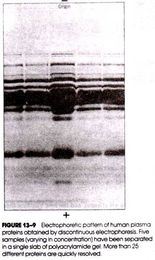 Electrophoretic Pattern of Human Plasma Proteins obtained by Discontinuous Electrophoresis