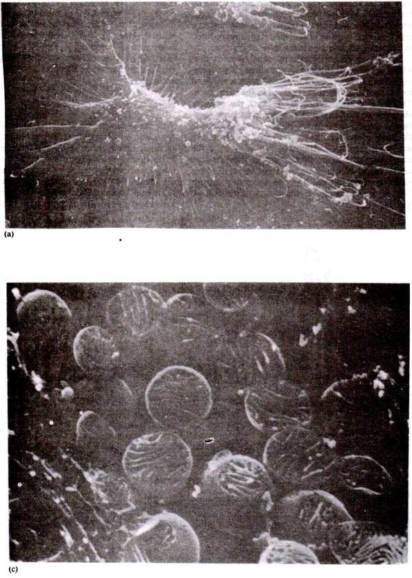 Examples of photomicrograph obtained using a scanning electron microscope