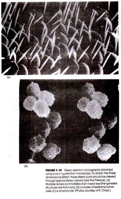 Stereo electron micrograph obtained using scaning electron microscopy