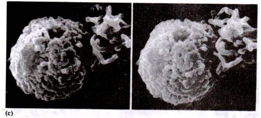 Stereo electron micrograph obtained using scaning electron microscopy