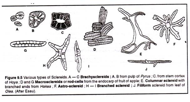 Various types of Sclereids