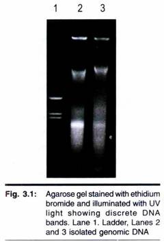 Agarose Gel