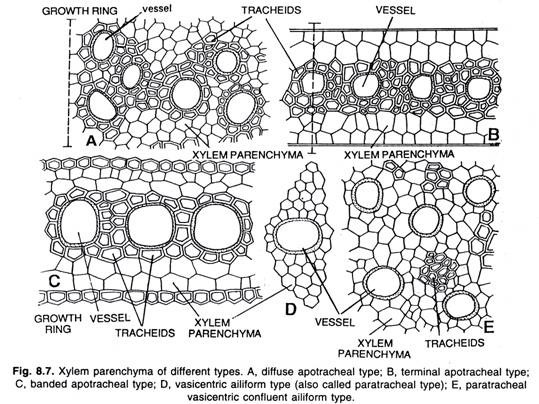 Xylem parenchya of different types