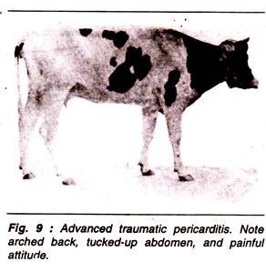 Advanced Traumatic Pericarditis