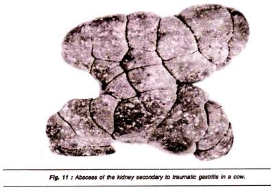 Abscess of the Kidney Secondary