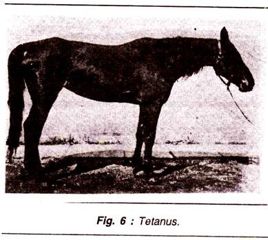 Tetanus