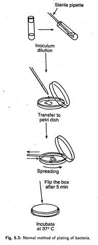 Normal Method of Plating of Bacteria