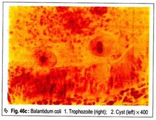 Balantidum Coli