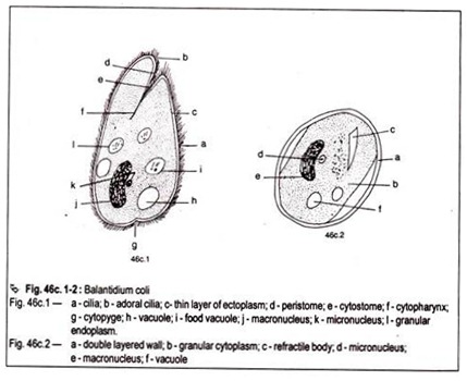 Balantidium Coli