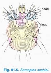 Sarcoptes Scabiei