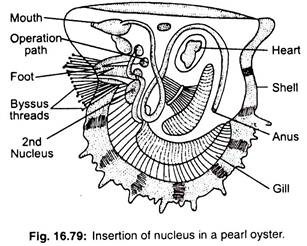 Insertion of nucleus in a pearl oyster