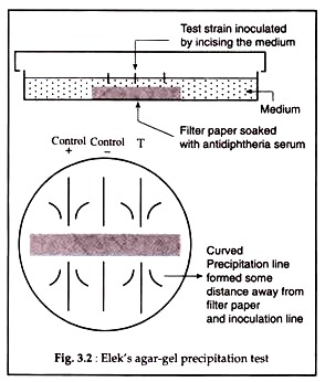 Elek's Agar-Gel Precipitation Test