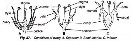 Conditions of Ovary