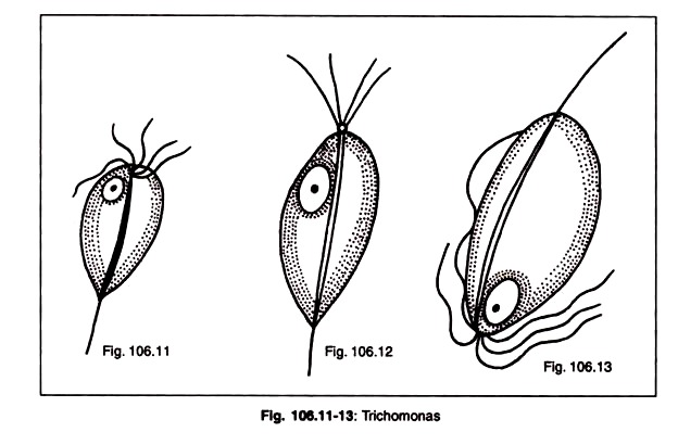 Trichomonas