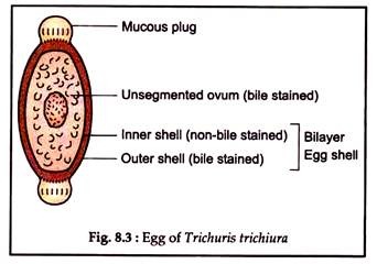 Egg of Trichuris Trichiura