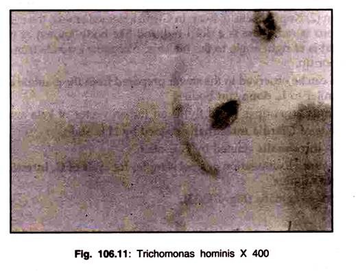 Trichomonas Horminis X 400