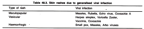 Skin rashes due to Generalised Viral Infection