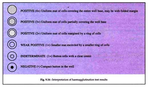 Interpretation of Haemagglutination Test Results