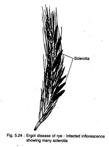 Ergot Disease of Rye: Infected Inflorescence Showing Many Sclerotia