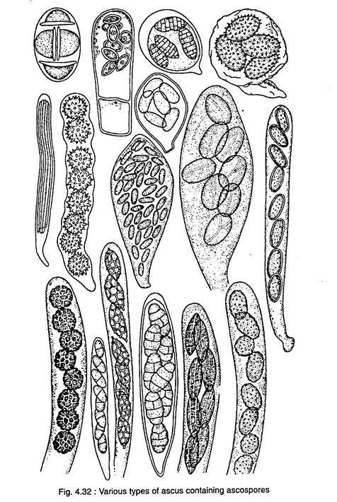 Various types of ascus containing ascospores