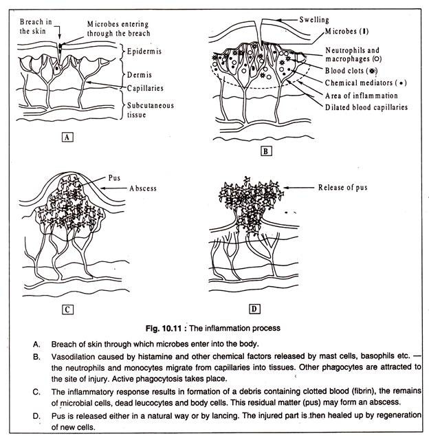 Inflammation Process