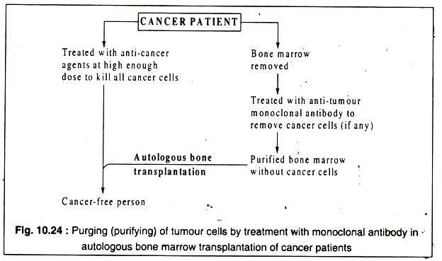 Puring of Tumor Cells