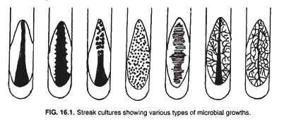 Streak cultures showing various types of microbial growths