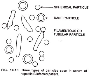 Three types of particles seen in serum of hepatitis B infected patient