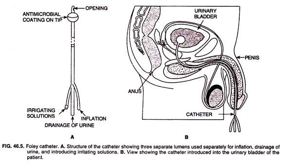 Foley catheter