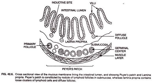 Cross sectional view of the mucous membrane lining the intestinal lumen and showing Peyer's patch and Lamina propria