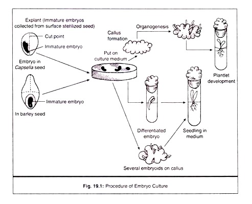 Procedure of Embryo Culture