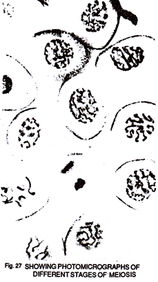 Photomicrographs of different stages of meiosis