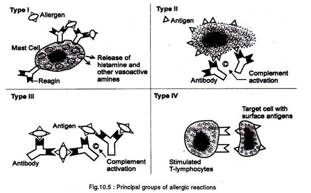 Principal groups of allergic reactions