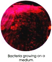 Bacteria Growing on a Medium