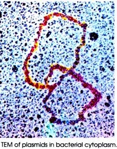 TEM of Plasmids in Bacterial Cytoplasm