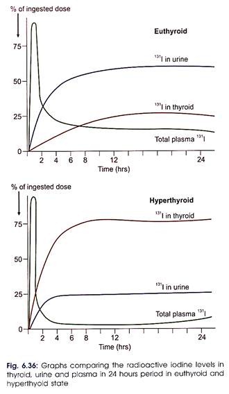 Radioactive Iodine Levels