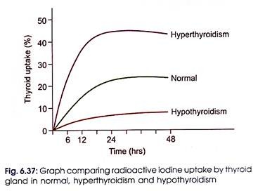 Radioactive Iodine Uptake