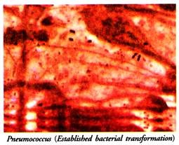 Pneumococcus