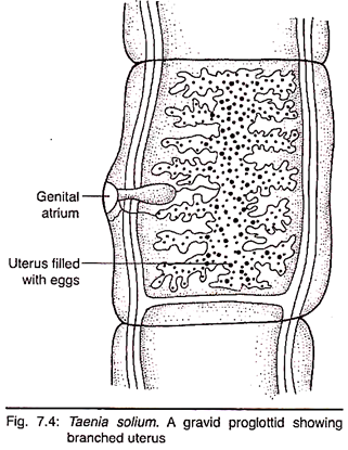 Gravid Proglottid Showing Branched Uterus