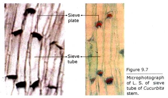 Microphotograph of L.S. of Sieve Tube of Cucurbita Stem