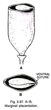 A-B Marginal Placentation