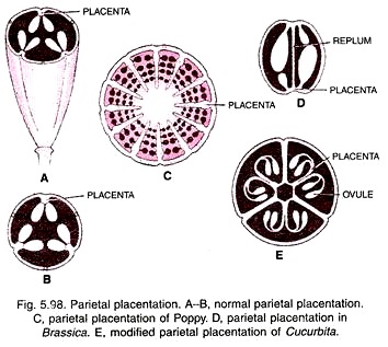 Parietal Placentation