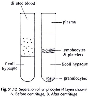 Diagram showing the difference in the first two pregnancies of an Rh- mother