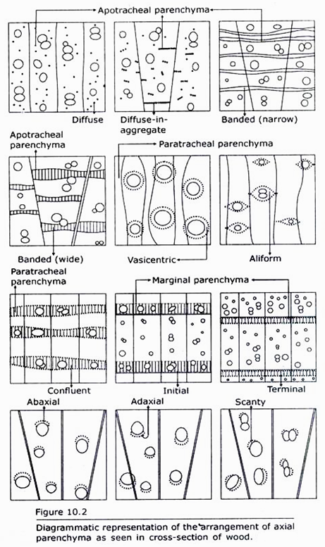 Arrangement of Axial Parenchyma as seen in Cross-section of Wood