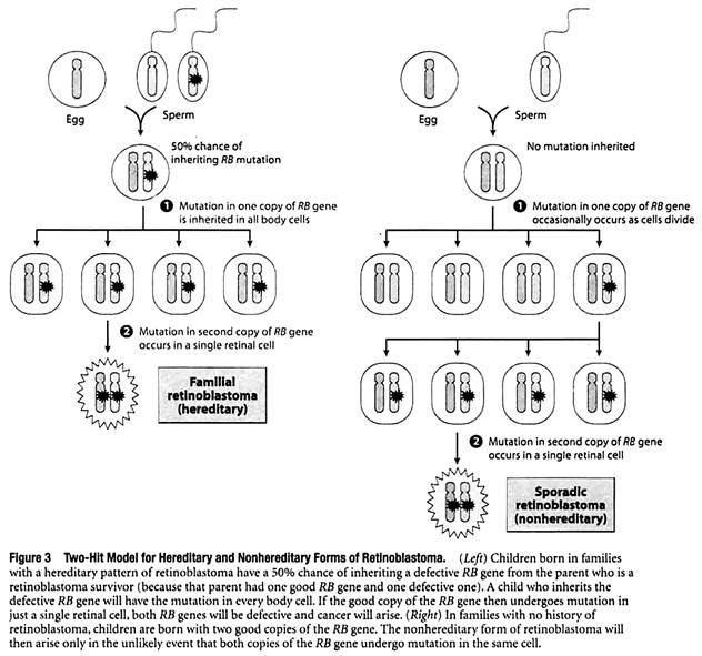 Two-Hit Model for Hereditary and Nonhereditary Forms of Retinoblastoma