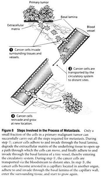 Steps Involved in the Process of Metastasis