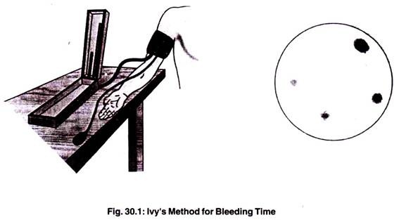 Ivy's Method for Bleeding Time