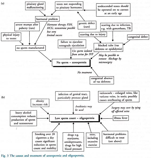 Causes and Treatment of Azoospermia and Oligospermia