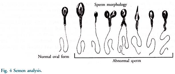 Semen Analysis